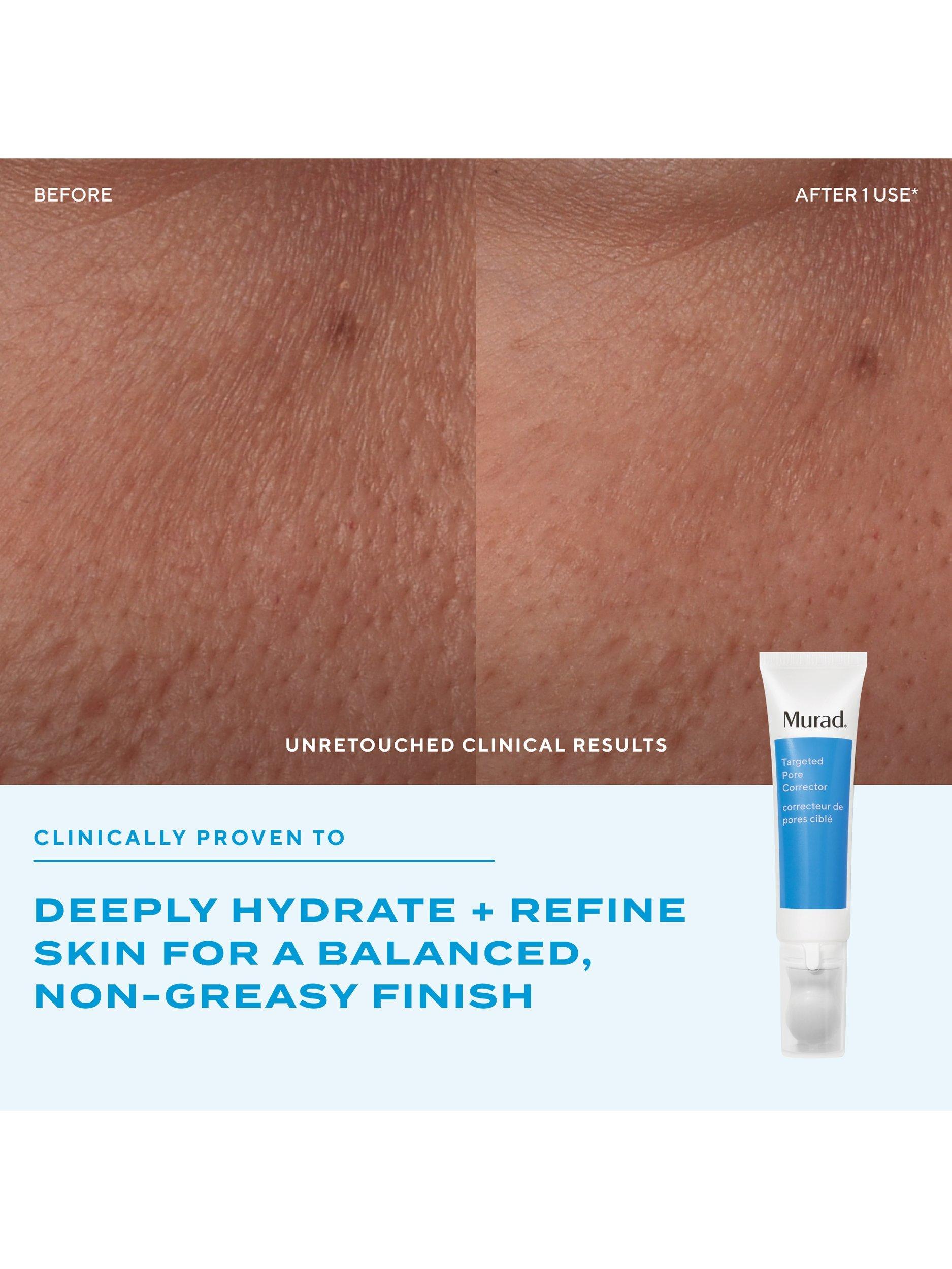 Murad Targeted Pore Corrector 15ml skincare product, UK version