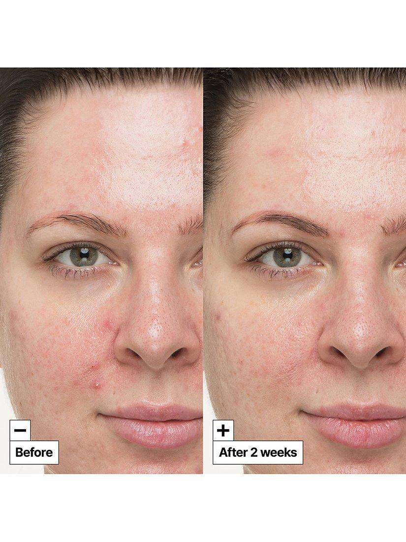 Dr.Jart+ Cicapair S.O.Soothing treatment 30ml - British product