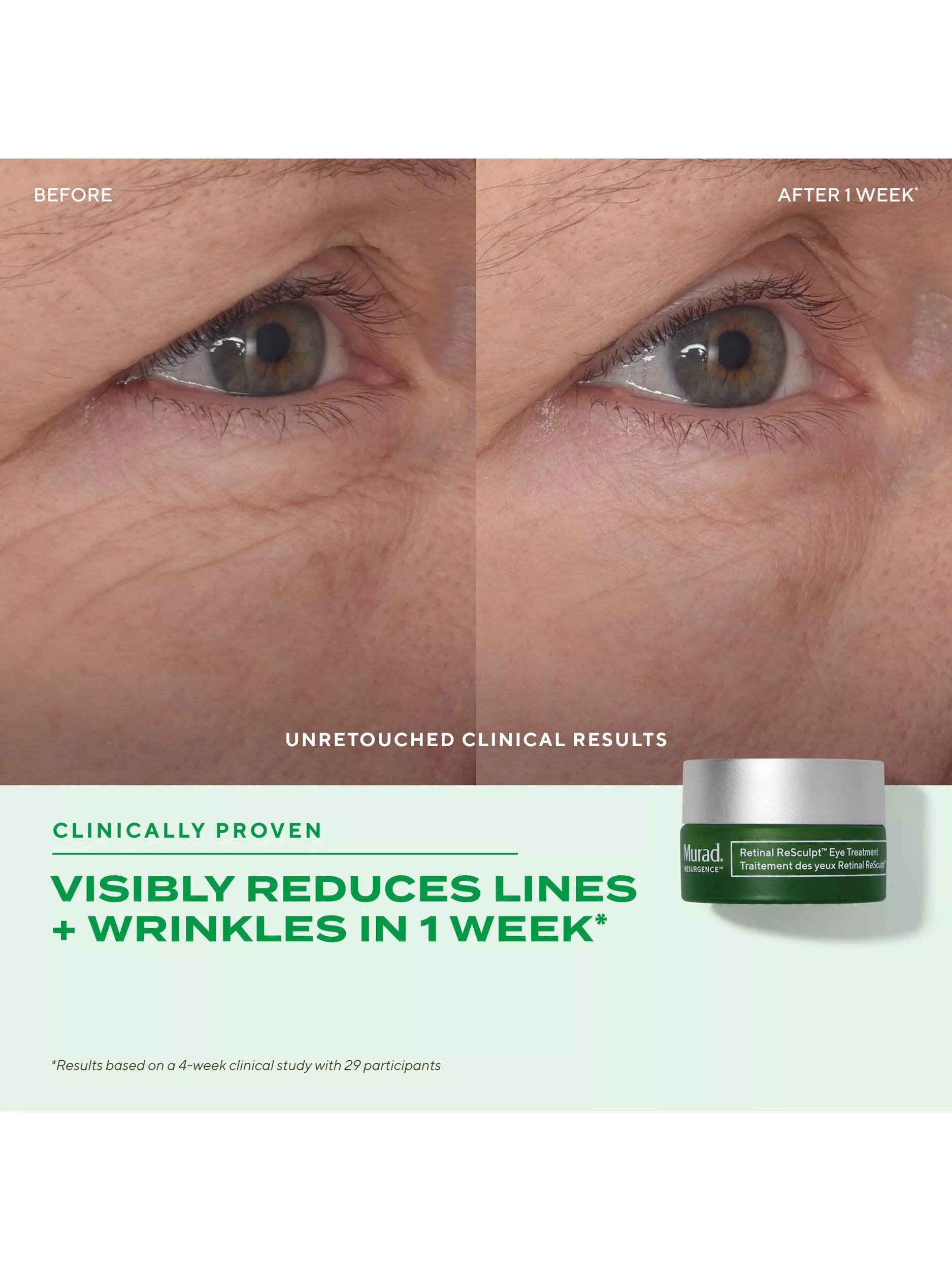 Murad Retinal ReSculpt eye treatment 15ml (British brand)