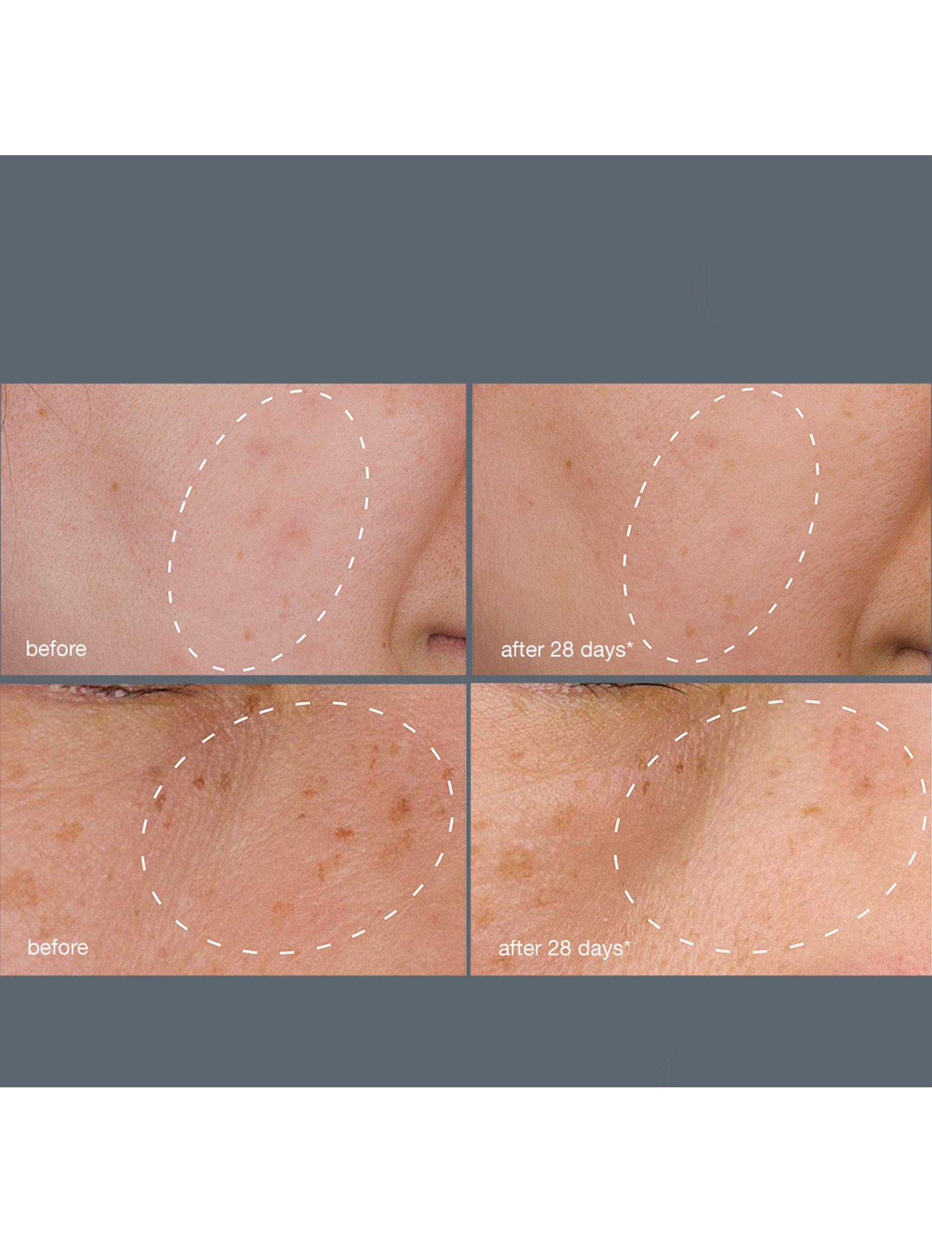 Dermalogica dark spot treatment system with serum and peel - British product