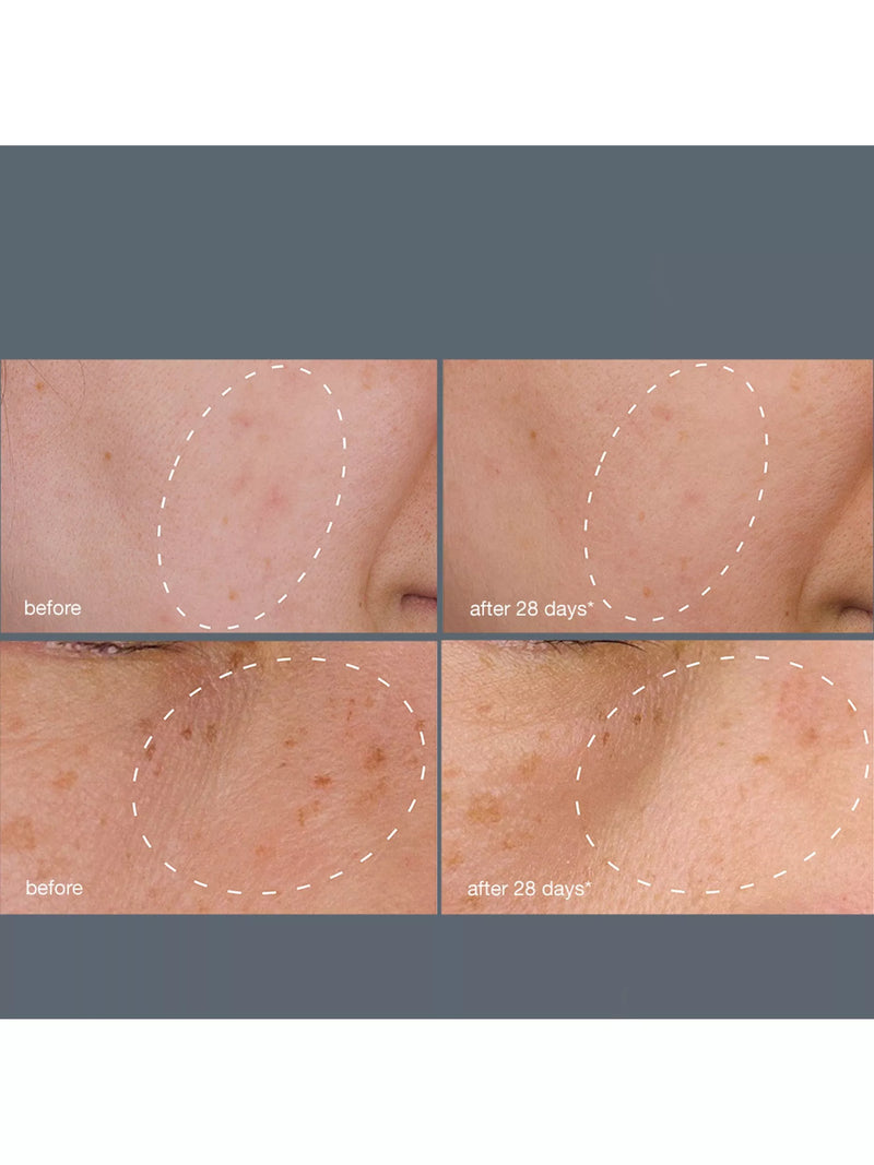 Dermalogica dark spot treatment system with serum and peel - British product