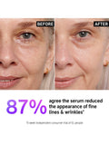 The INKEY List Retinol Serum slow-release 30ml, UK version