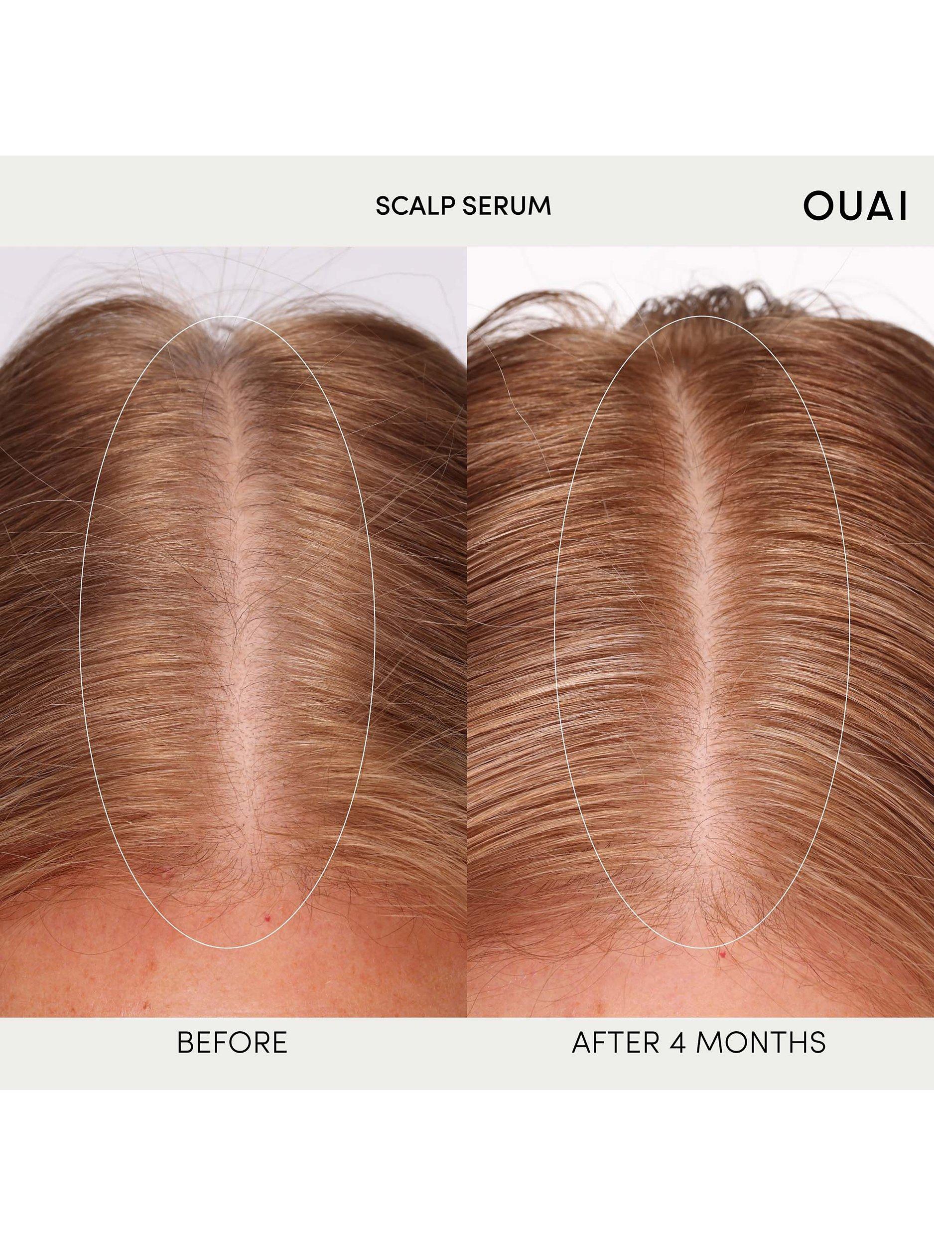 OUAI scalp serum 60ml, imported from the UK