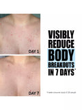The INKEY List glycolic acid body stick 45g, imported from the UK