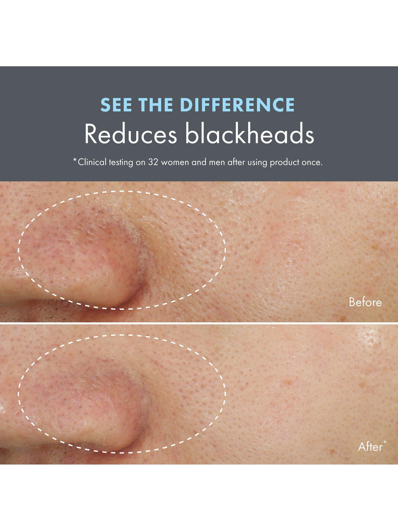 Origins Clear Improvement Blackhead Mask to Scrub 75ml, UK version