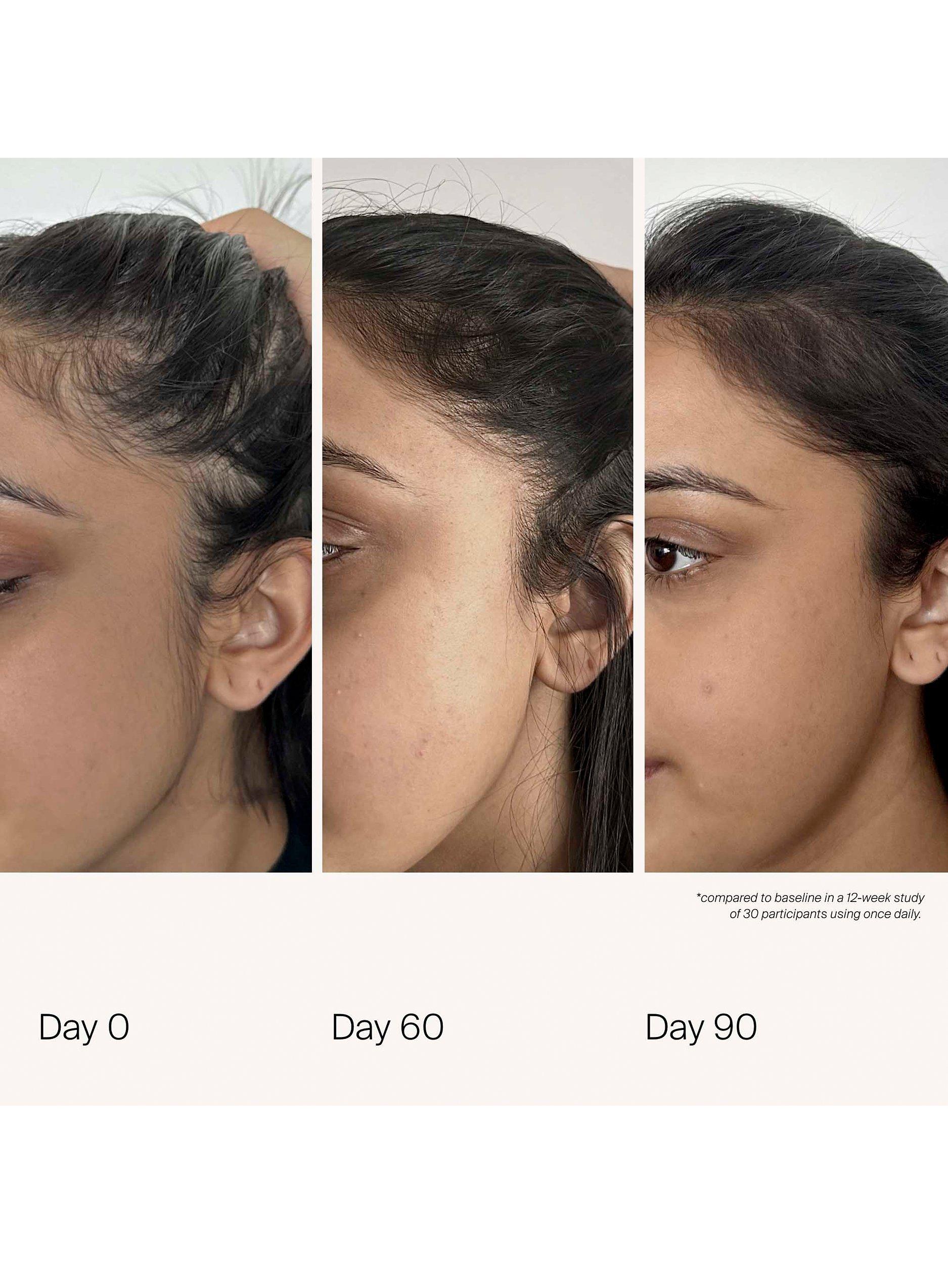 Living Proof scalp density serum 50ml - British product