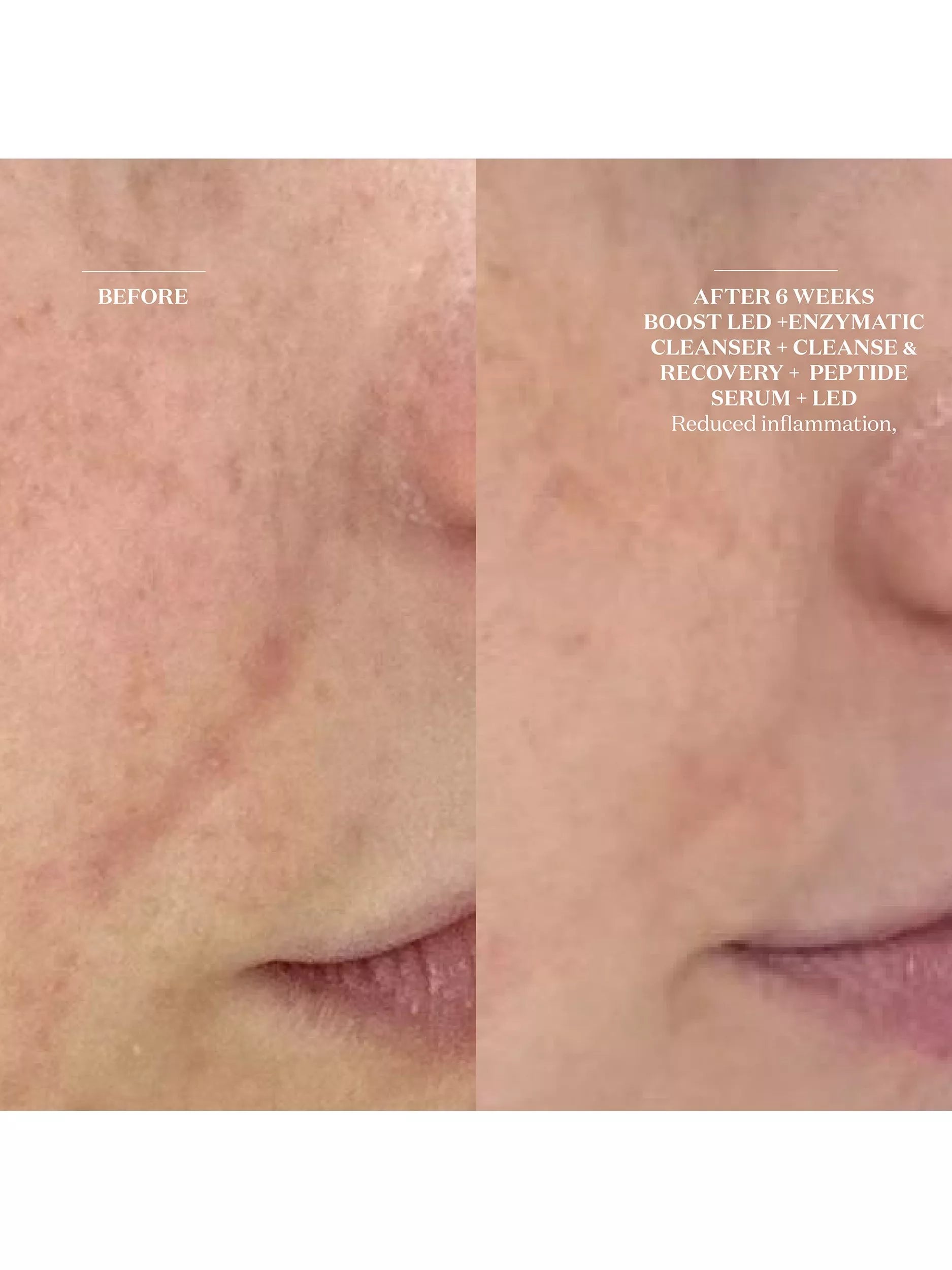 The Light Salon Enzymatic Cleanser & Mask 150ml, UK version