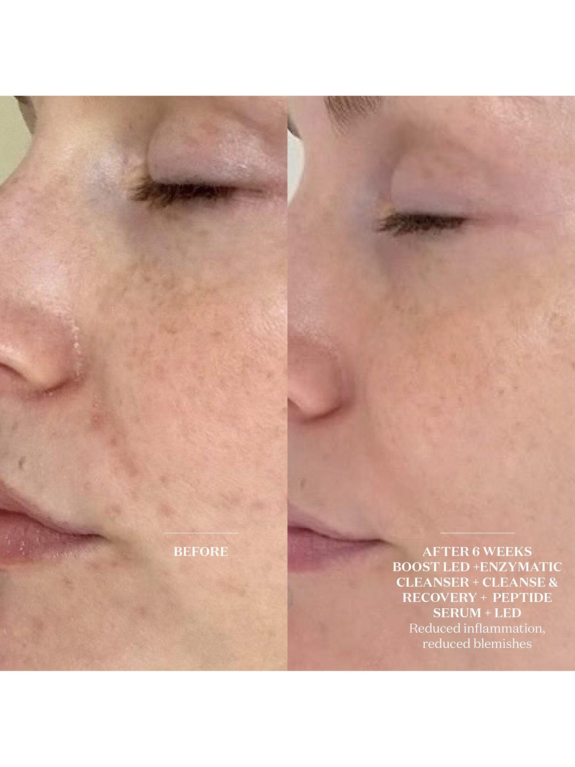 The Light Salon Enzymatic Cleanser & Mask 150ml, UK version