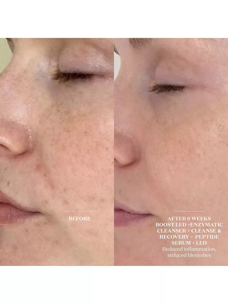 The Light Salon Enzymatic Cleanser & Mask 150ml, UK version