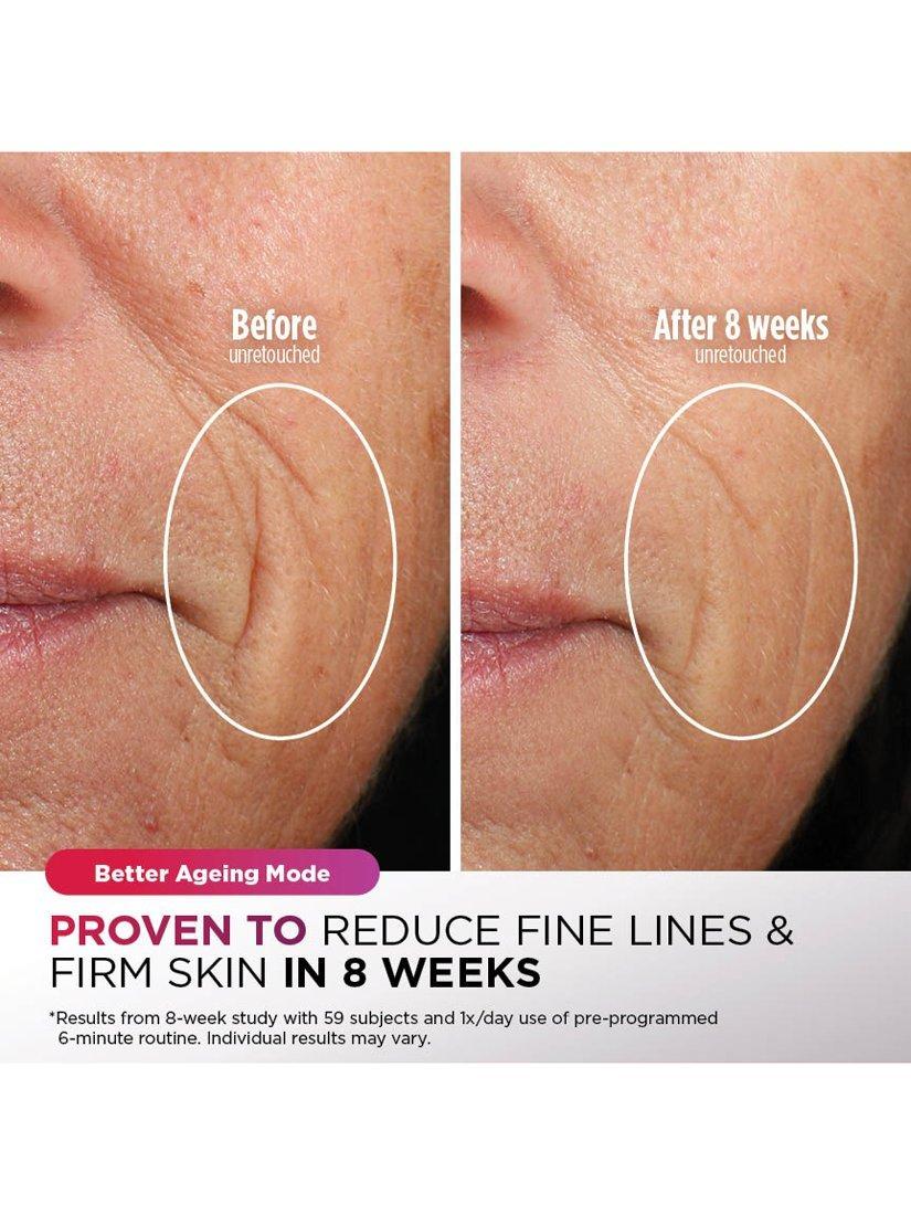 Shark CryoGlow LED Anti-Aging-Maske mit Fernbedienung, importiert aus dem Vereinigten Königreich