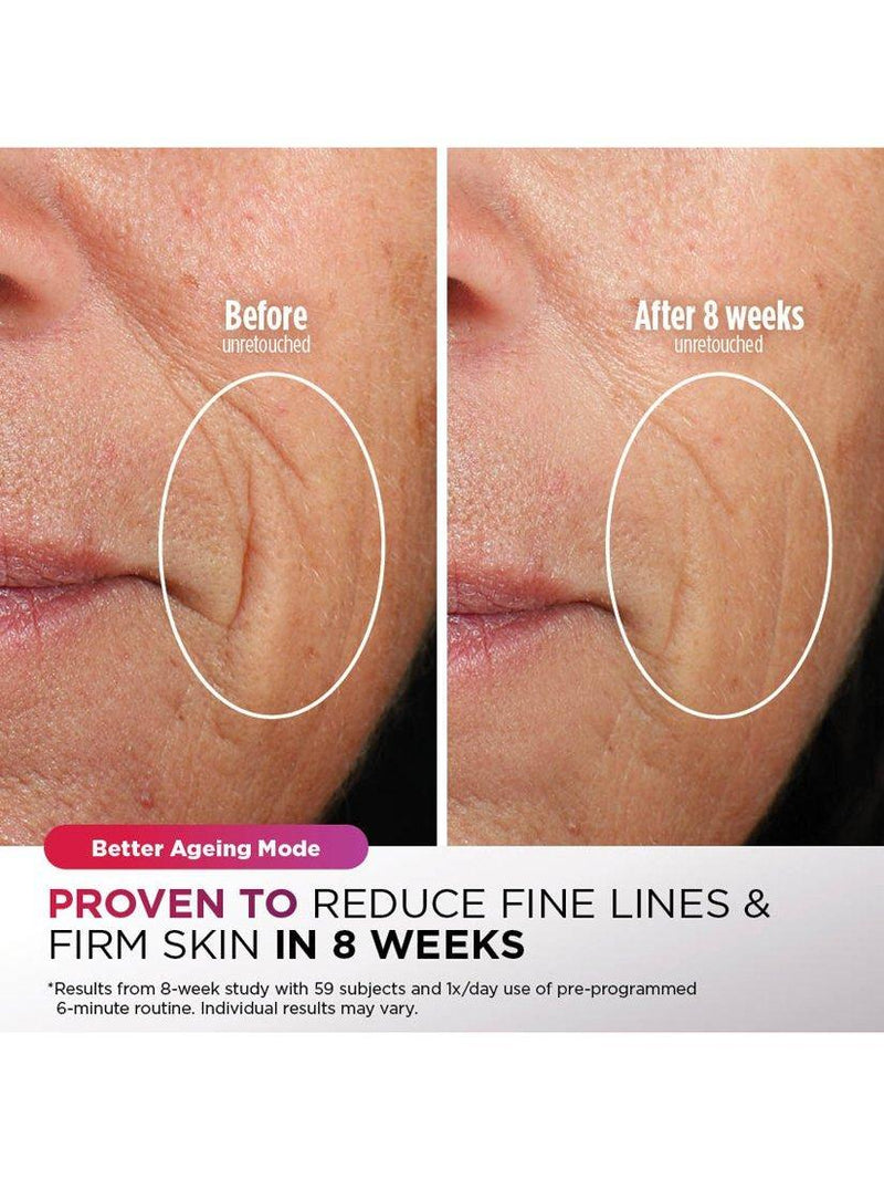 Shark CryoGlow LED Anti-Aging-Maske mit Fernbedienung, importiert aus dem Vereinigten Königreich