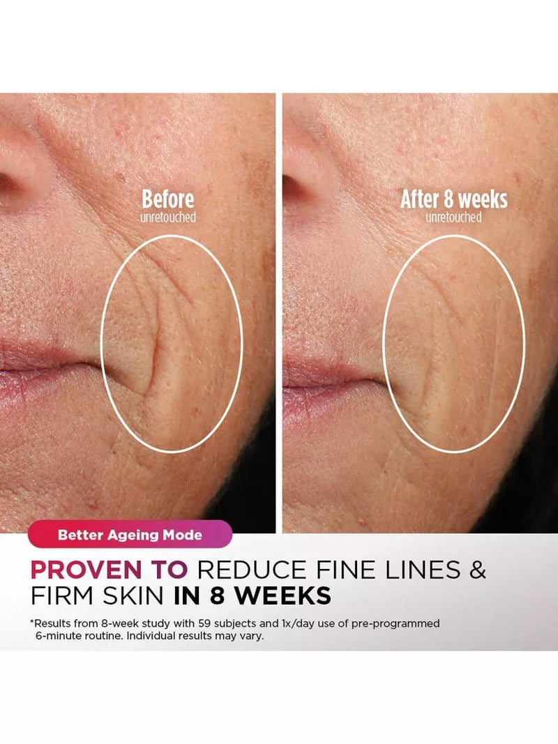 Shark CryoGlow LED anti-ageing mask with remote, imported from the UK