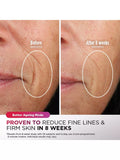 Shark CryoGlow LED anti-ageing mask with remote, imported from the UK