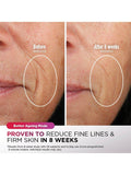Shark CryoGlow LED Anti-Aging-Maske mit Fernbedienung, importiert aus dem Vereinigten Königreich