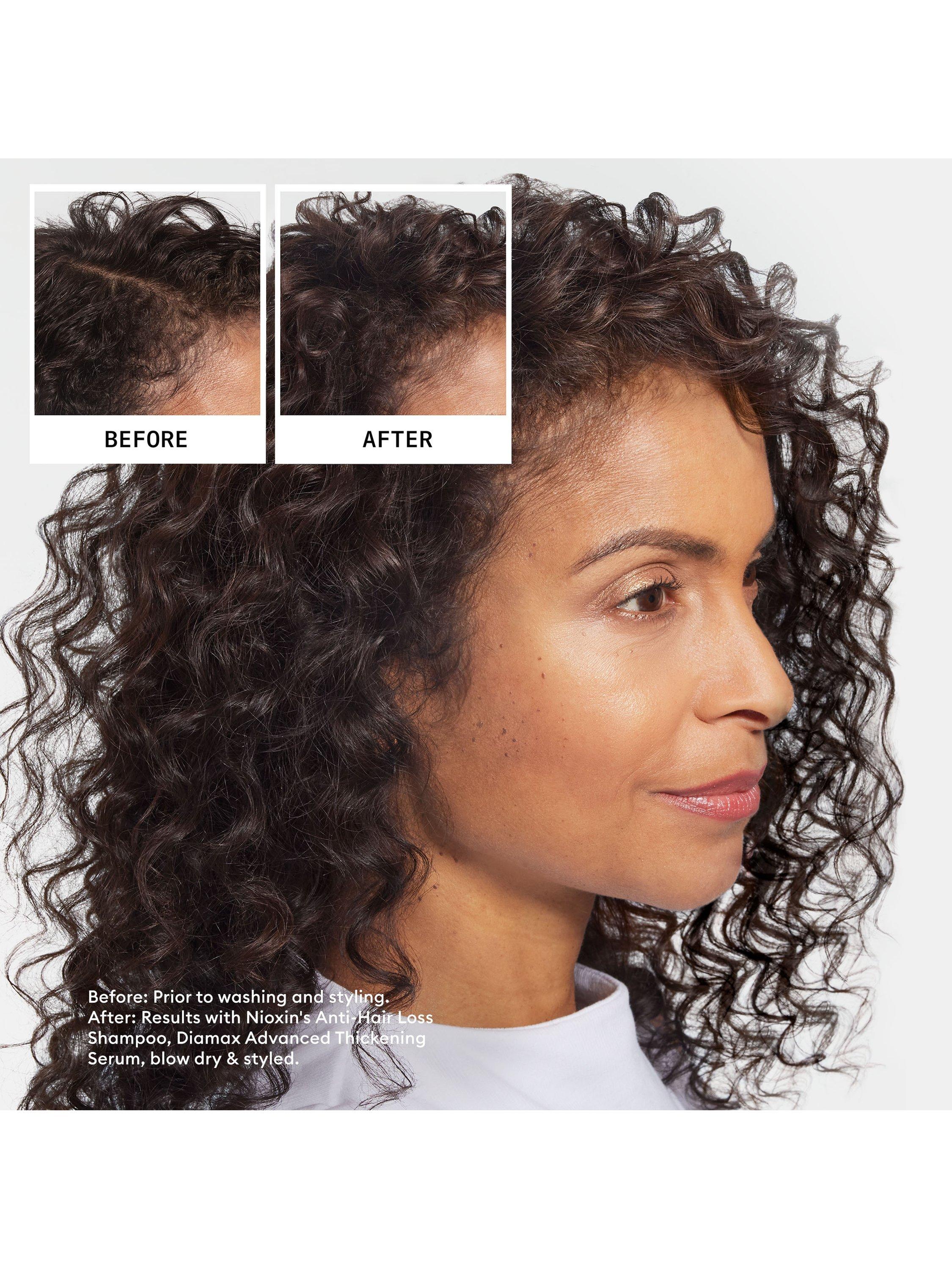 Nioxin Anti-Hair Loss Shampoo 240ml, imported from the UK