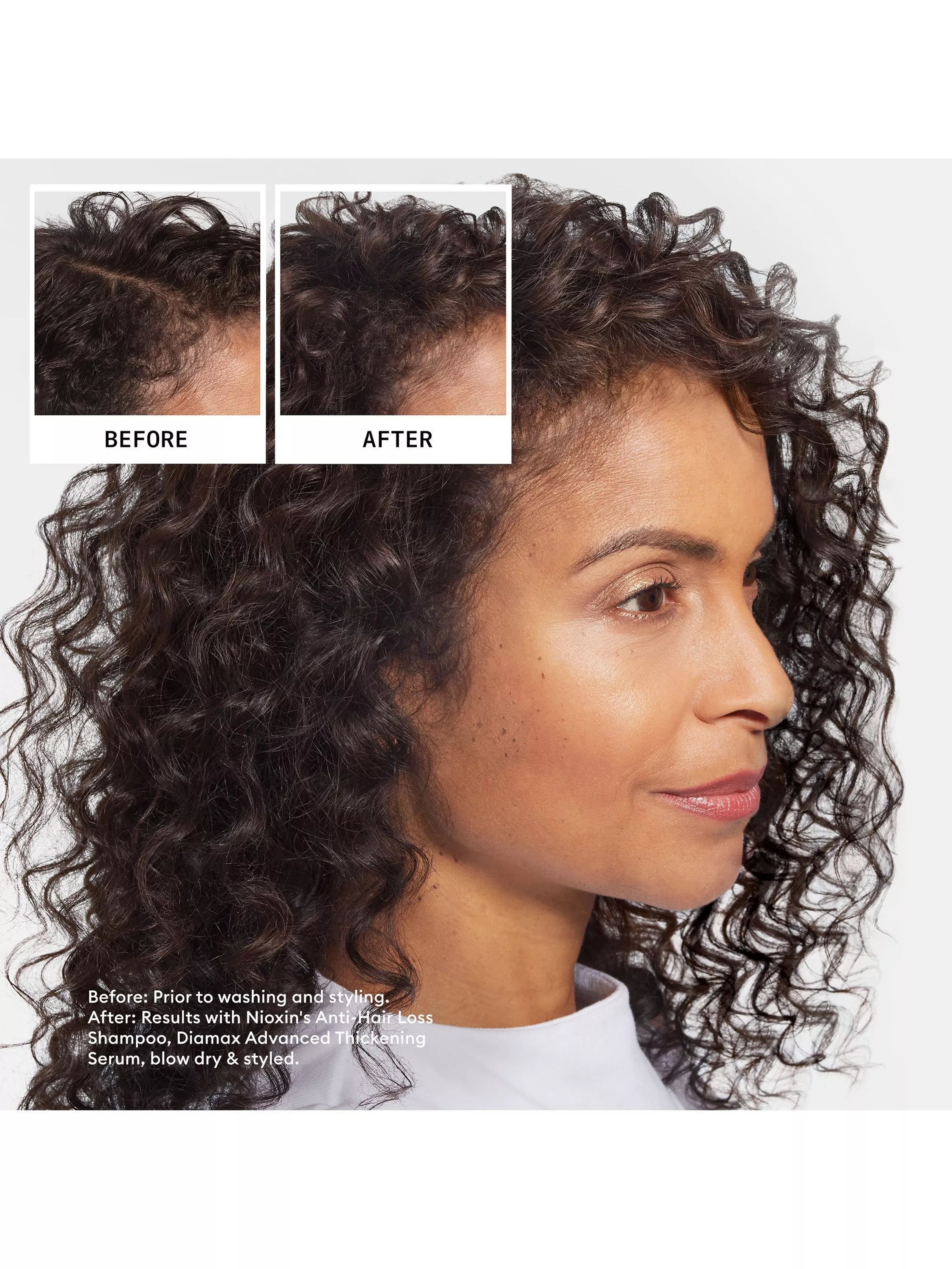 Nioxin Anti-Hair Loss Shampoo 240ml, imported from the UK
