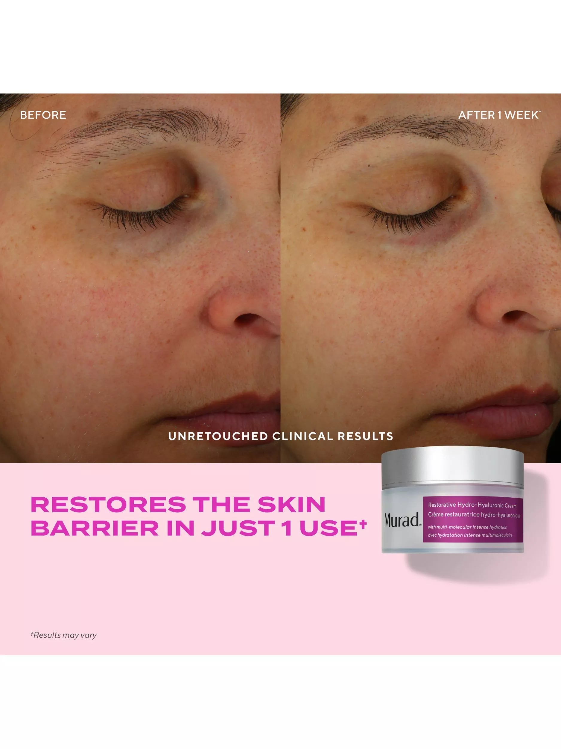 Murad Restorative Hydro-hyaluronic Cream 50ml, imported from the UK