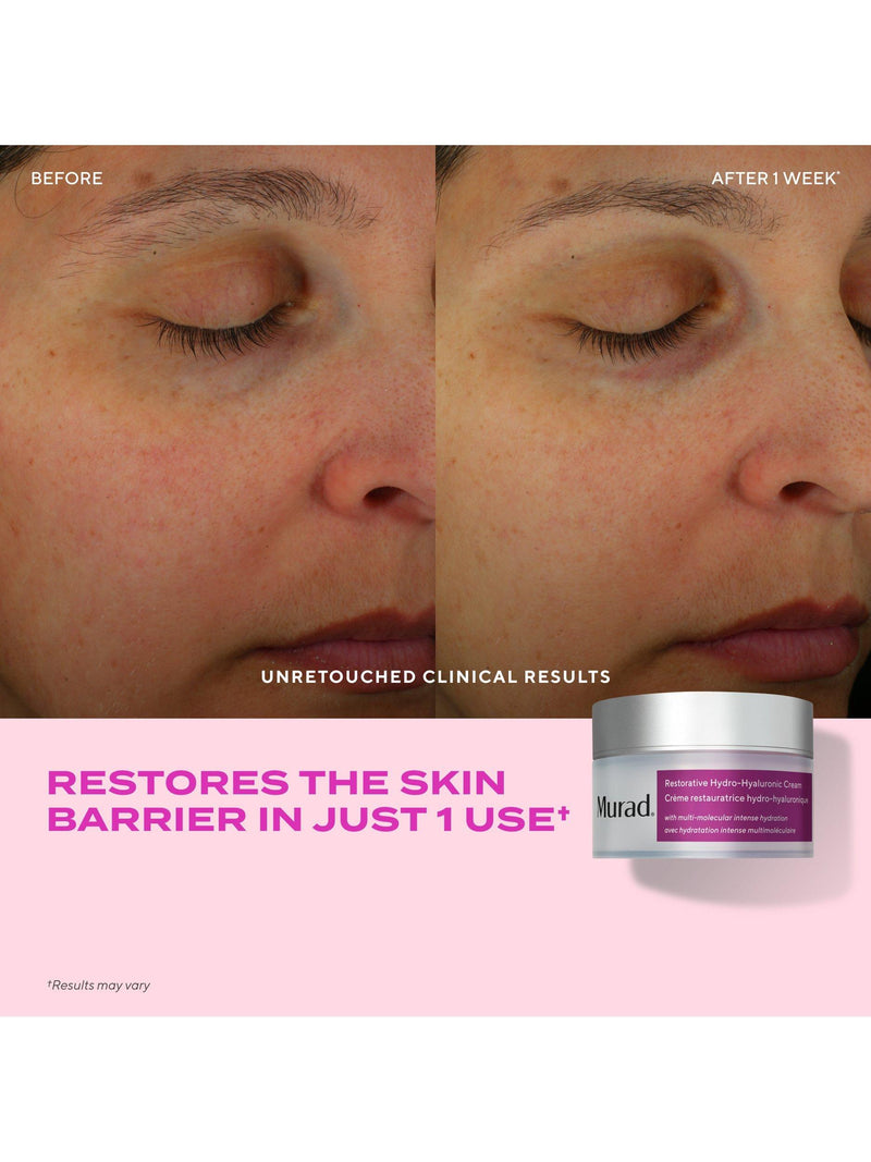 Murad Restorative Hydro-Hyaluronic Cream 50ml, imported from the UK