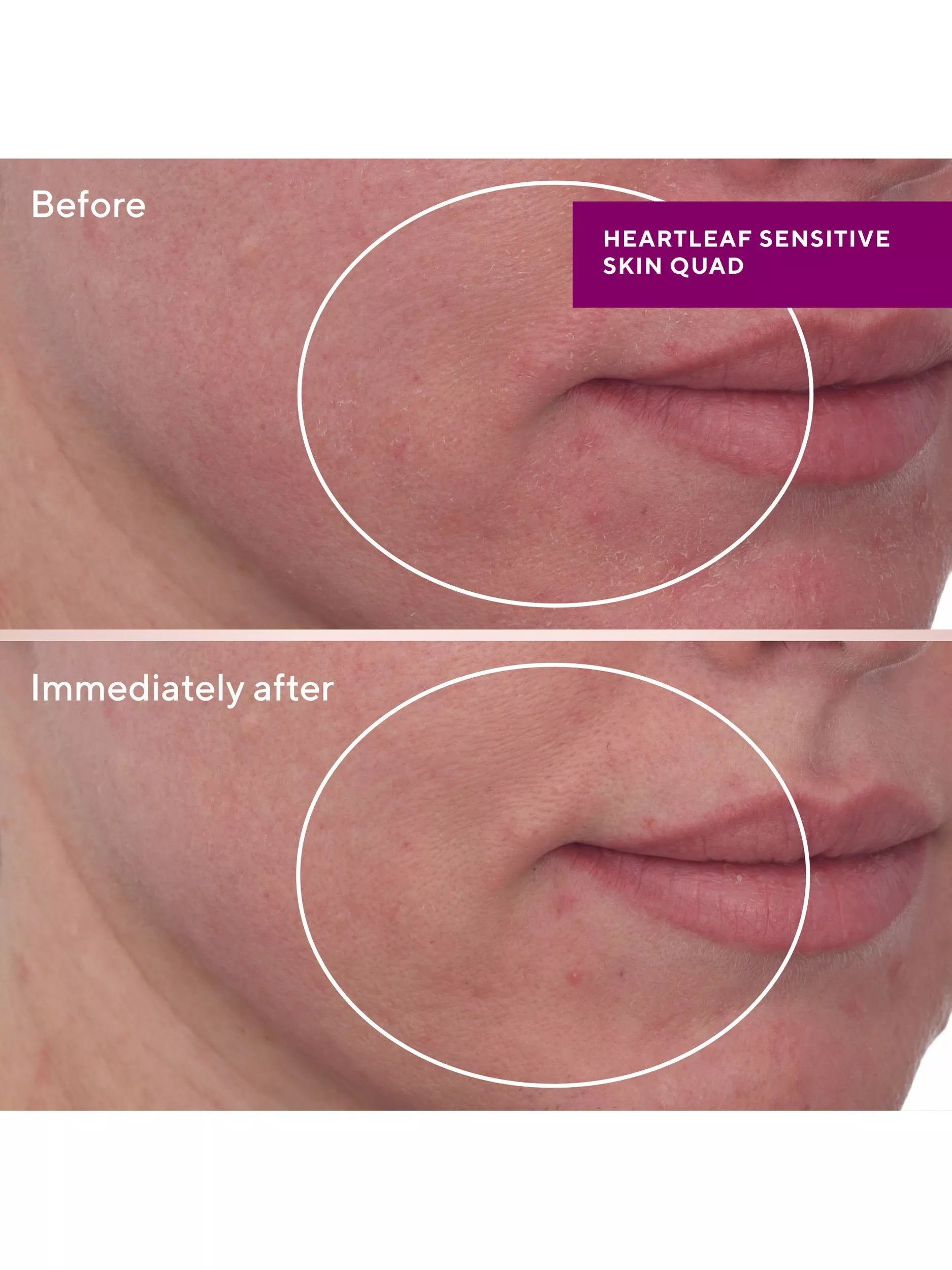 Murad Heartleaf Gentle Resurfacing Serum 30ml, imported from the UK