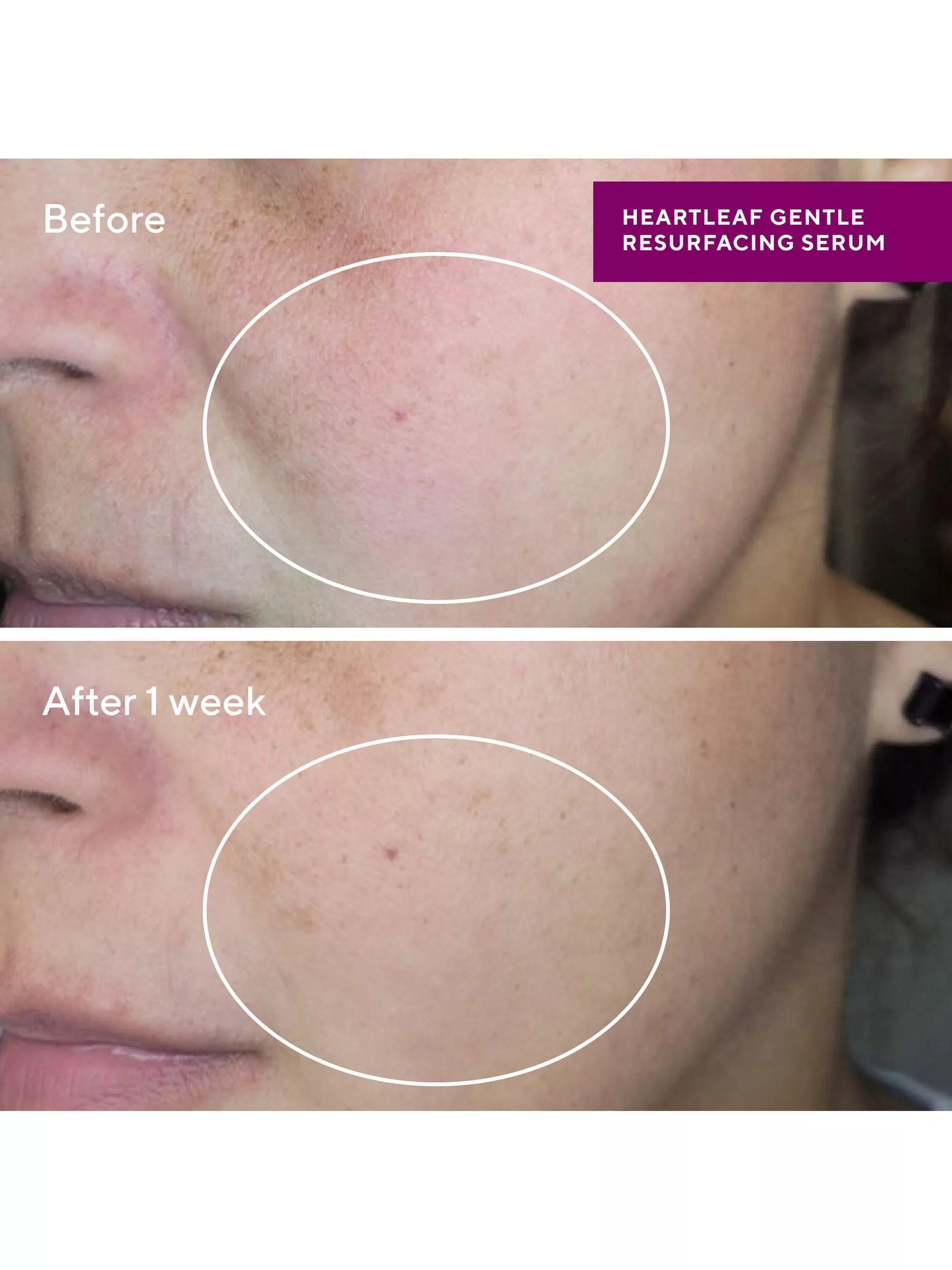 Murad Heartleaf Gentle Resurfacing Serum 30ml, imported from the UK