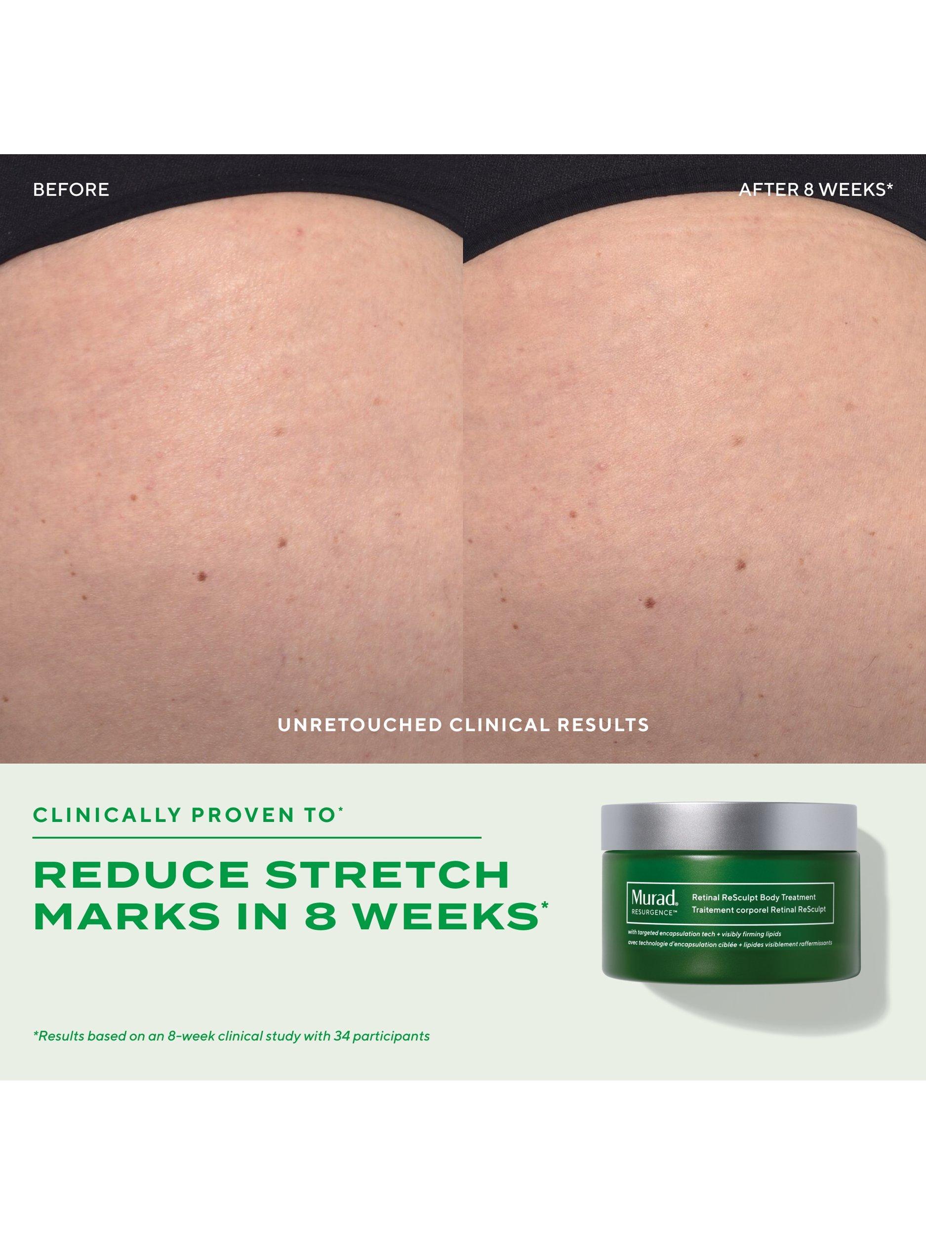 Murad Retinal ReSculpt body treatment 148ml, UK version