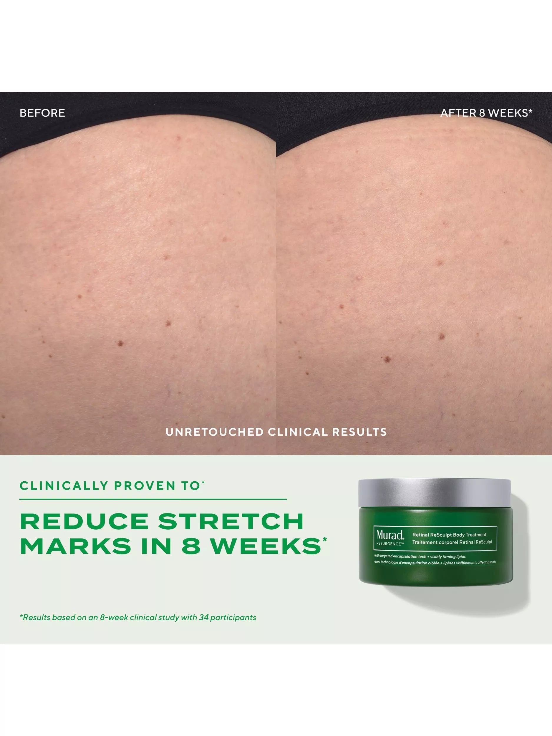 Murad Retinal ReSculpt body treatment 148ml, UK version