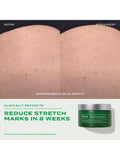 Murad Retinal ReSculpt body treatment 148ml, UK version