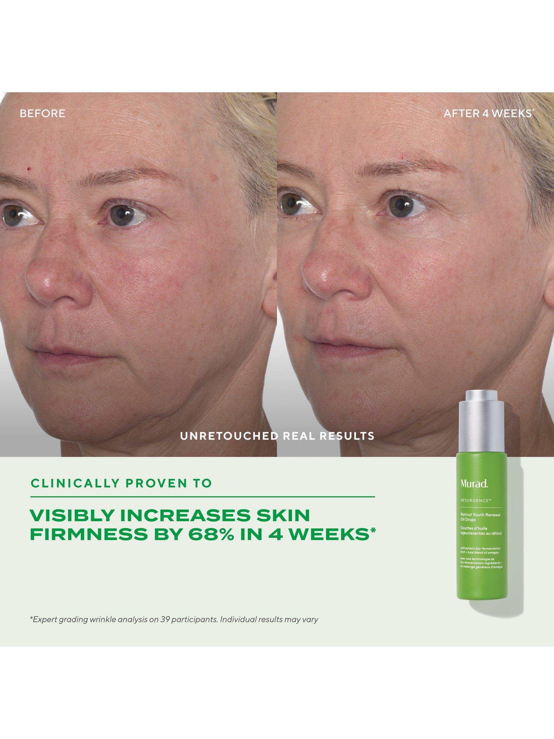 Murad Retinol Youth Renewal Oil Drops 30ml, imported from the UK