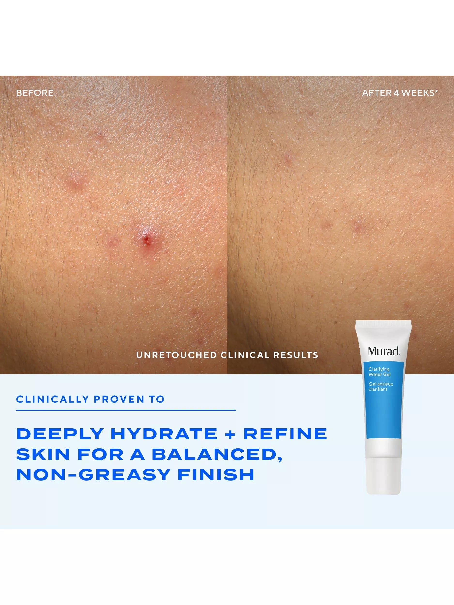 Murad clarifying water gel 60ml - British product