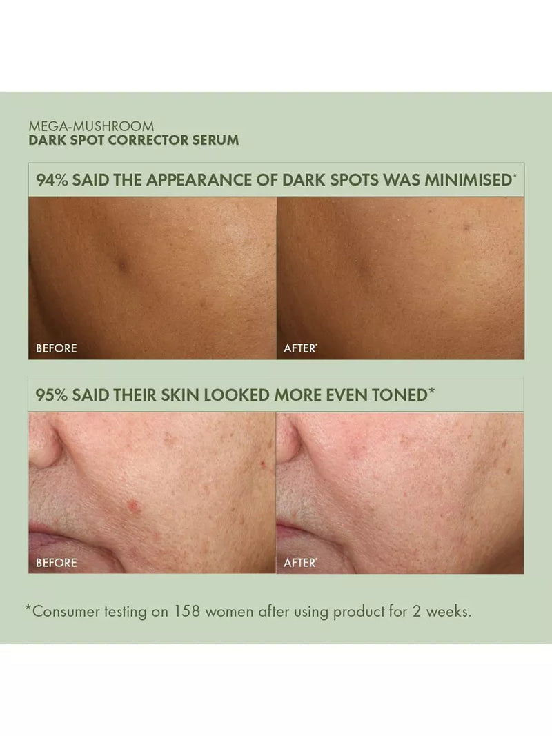 Origins Mega-Mushroom Dark Spot Serum 30ml imported from the UK