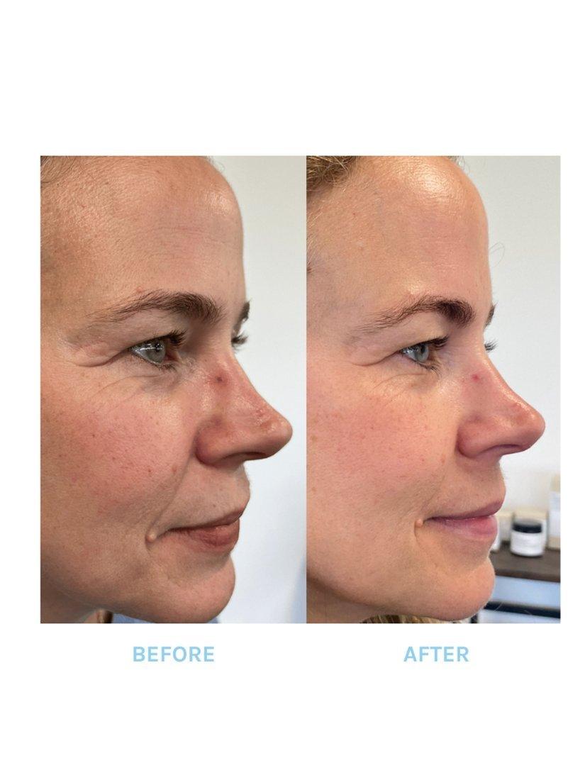 Evolve Organic Beauty Age Defying Lifting Serum 30ml - British product