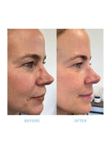 Evolve Organic Beauty Age Defying Lifting Serum 30ml - British product