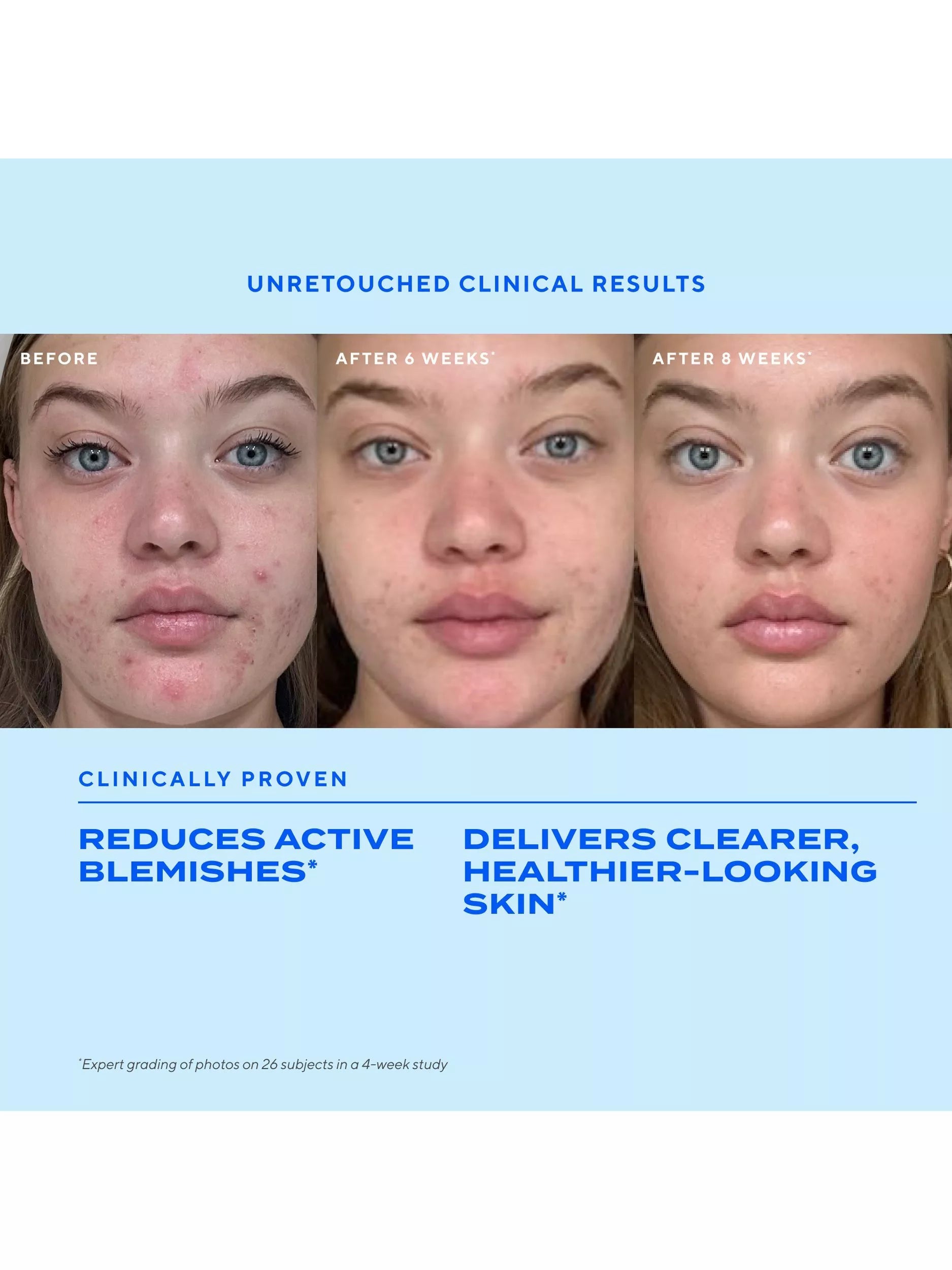 Murad blemish treatment serum 30ml, UK version