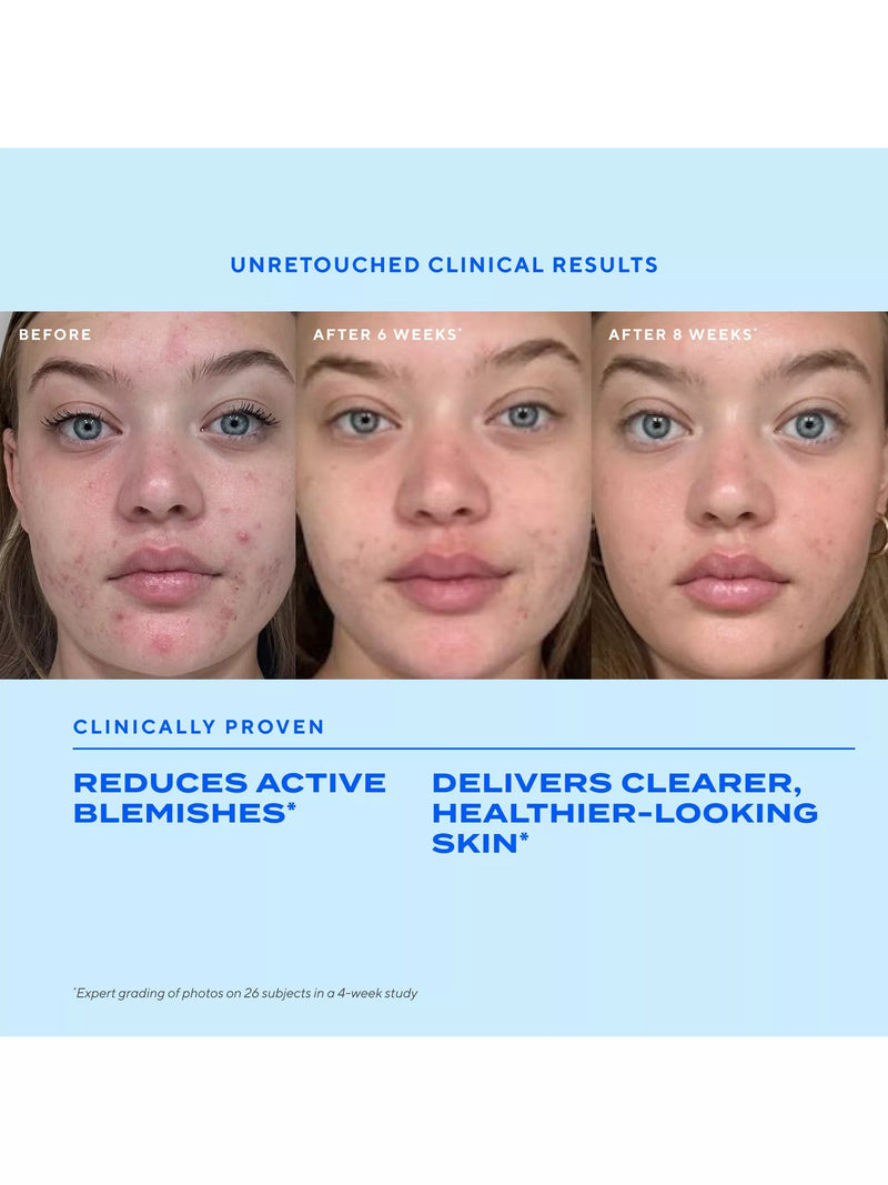 Murad blemish treatment serum 30ml, UK version