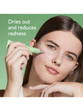 Caudalie Vinopure spot treatment 15ml, imported from the UK