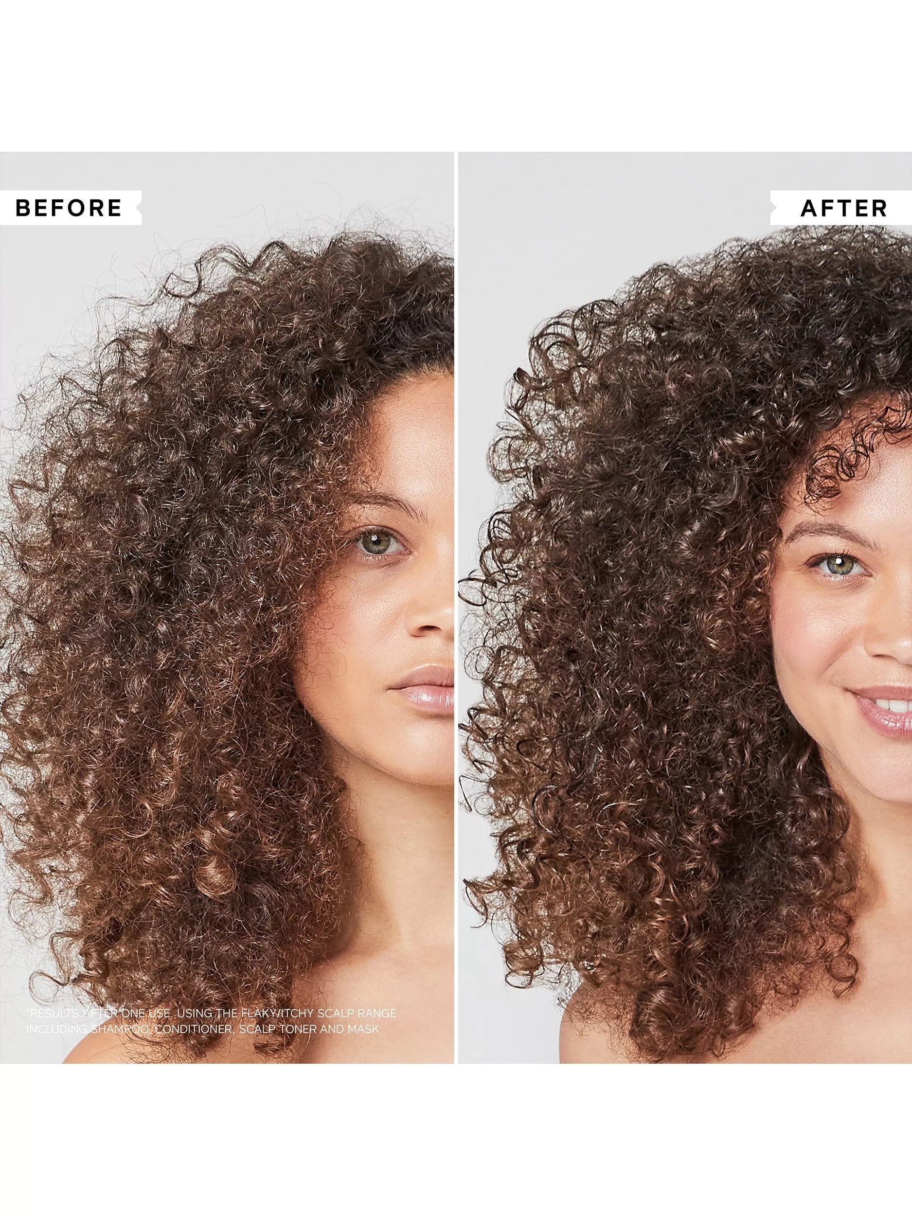 Philip Kingsley anti-dandruff shampoo for curly hair 250ml, imported from the UK
