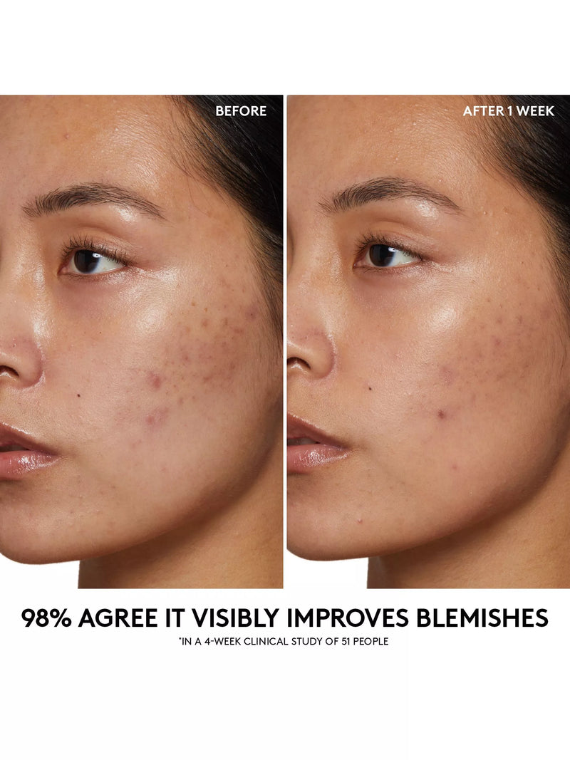 Fenty Skin cherry pore purifying gel cleanser 190ml - British product