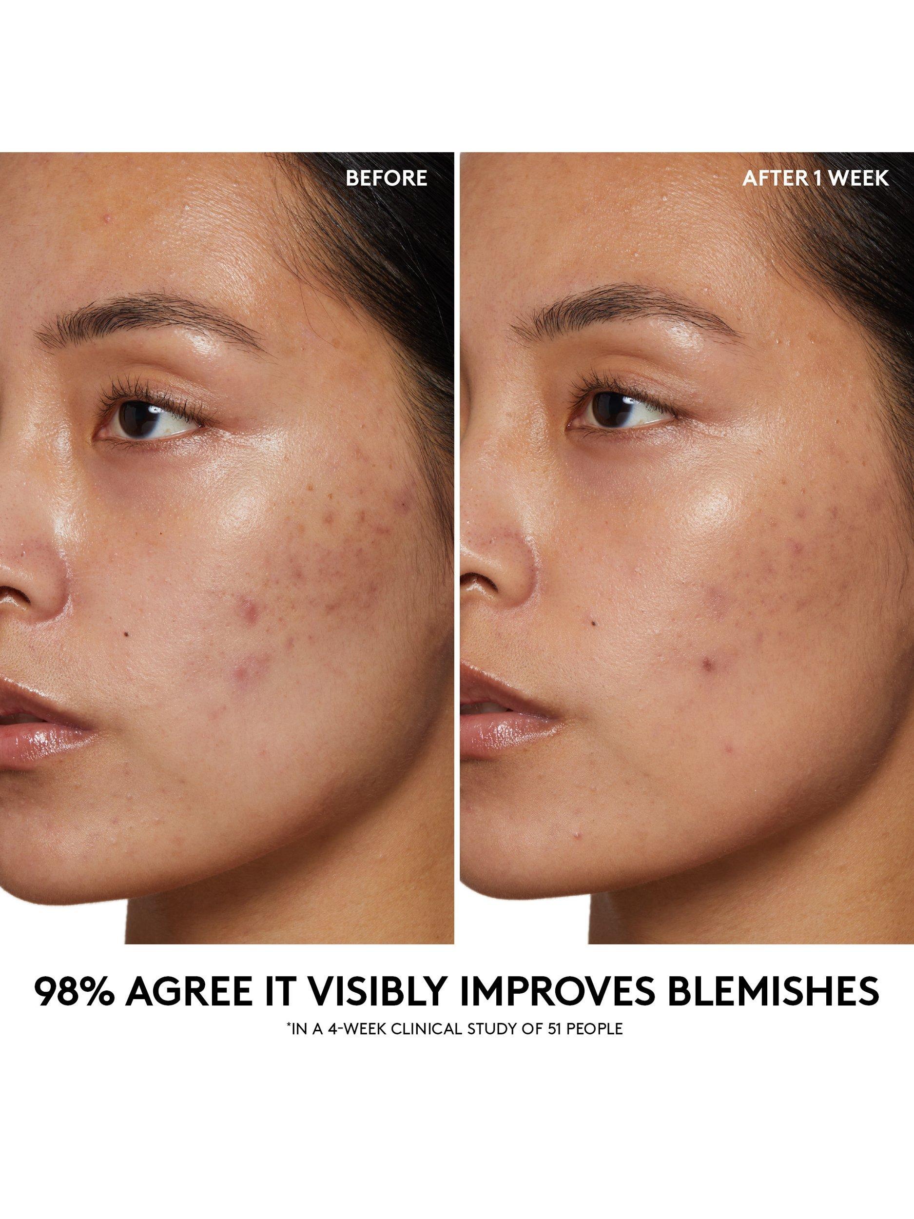 Fenty Skin cherry pore purifying gel cleanser 190ml - British product