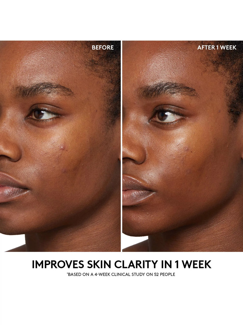 Fenty Skin BHA cherry purifying toner 150ml - British product