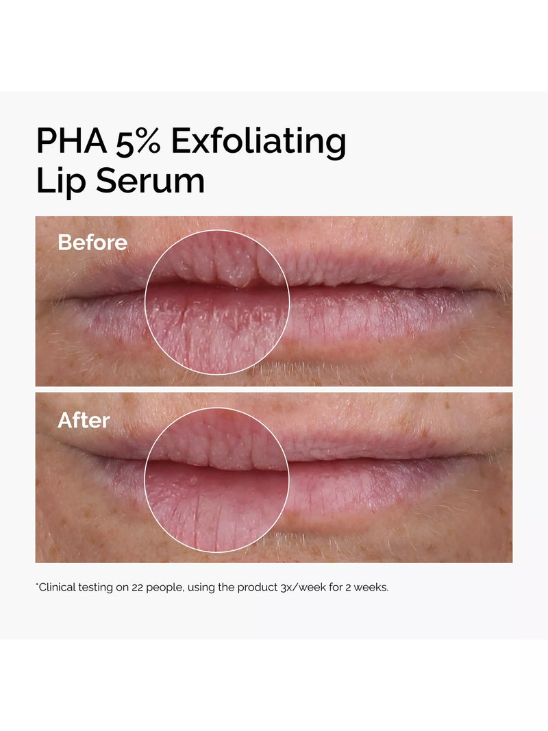 The Ordinary PHA 5% exfoliating lip serum 15ml (British brand)