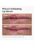 The Ordinary PHA 5% exfoliating lip serum 15ml (British brand)