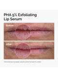 The Ordinary PHA 5% Exfoliating Lip Serum 15ml (British brand)