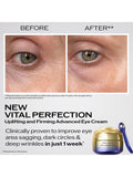 Shiseido Vital Perfection Uplifting and Firming Eye Cream 15ml (British brand)