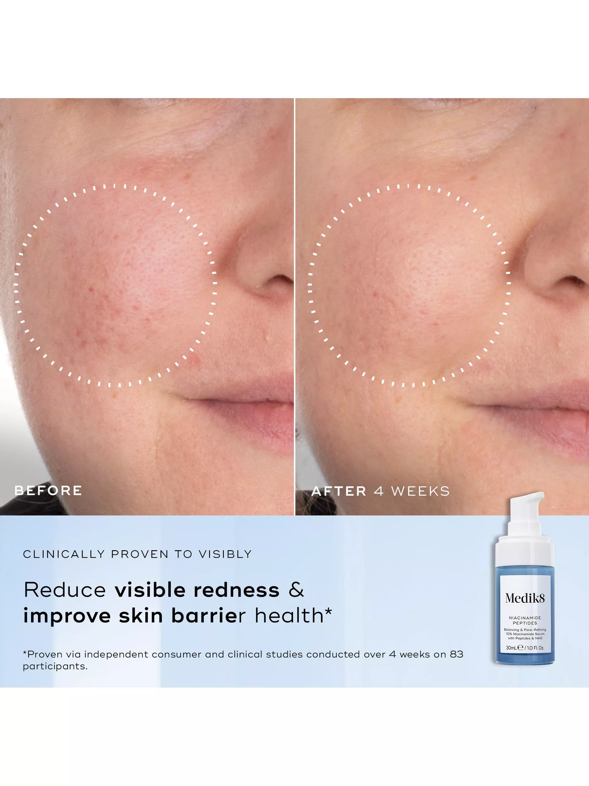 Medik8 Niacinamide Peptides serum 30ml, imported from the UK