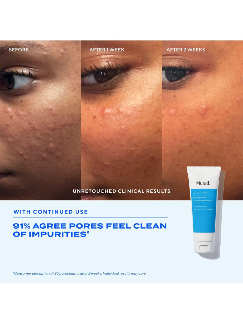 Murad Blemish Control Clarifying Cleanser 148ml, UK version