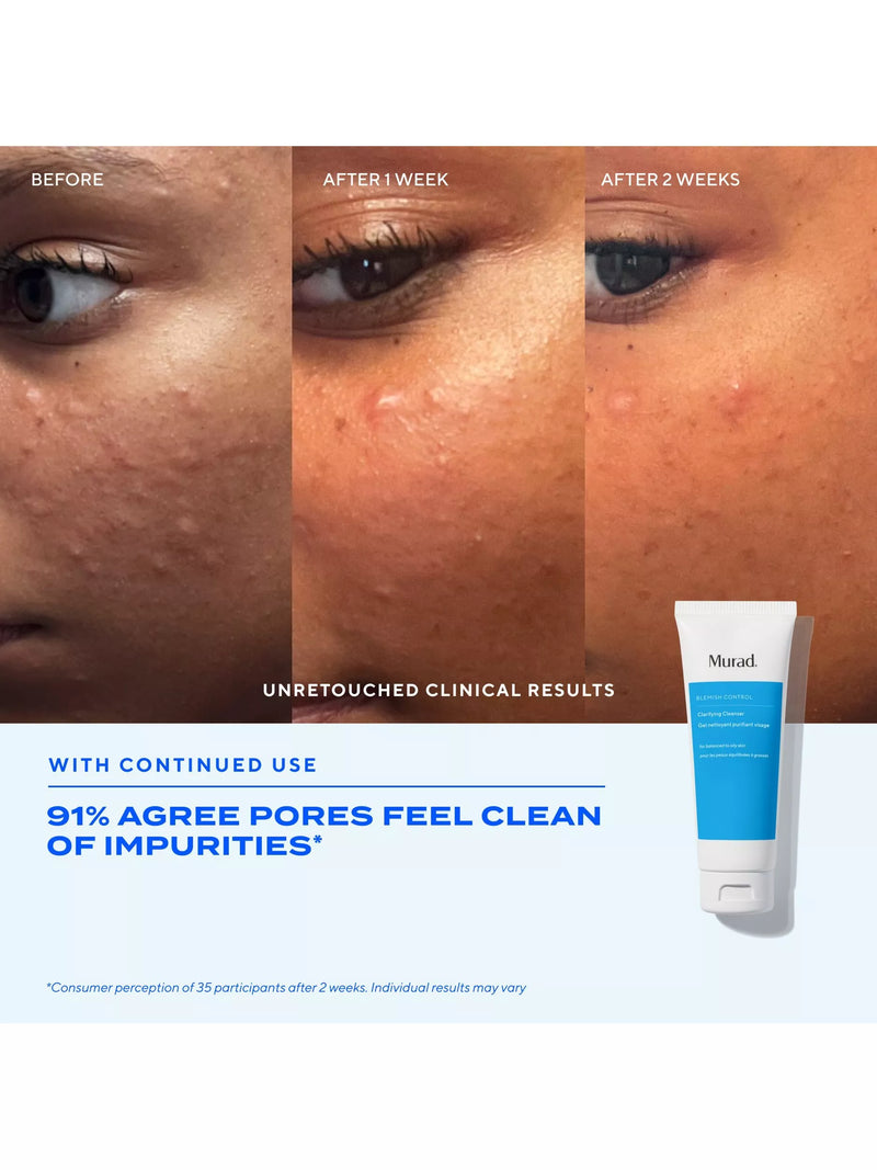 Murad Blemish Control Clarifying Cleanser 148ml, UK version