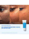 Murad Blemish Control Clarifying Cleanser 148ml, UK version