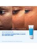 Murad Blemish Control Clarifying Cleanser 148ml, UK version