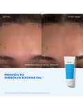 Murad Blemish Control Clarifying Cleanser 148ml, UK version