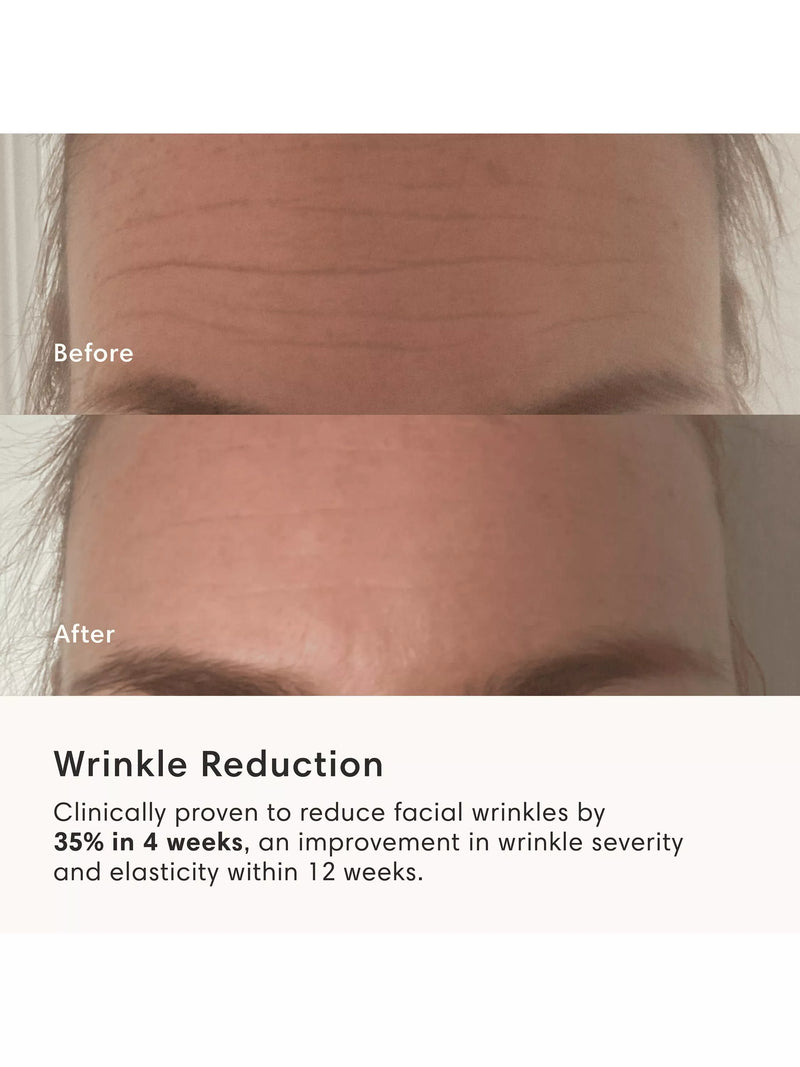 The Light Salon Boost LED Mask device, imported from the UK